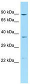 Protein Phosphatase 1 Regulatory Subunit 12C antibody, TA331892, Origene, Western Blot image 
