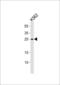 RAB27A, Member RAS Oncogene Family antibody, LS-C155898, Lifespan Biosciences, Western Blot image 