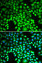Proteasome Subunit Alpha 4 antibody, 15-050, ProSci, Immunofluorescence image 