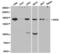 SIN3 Transcription Regulator Family Member A antibody, TA327087, Origene, Western Blot image 