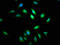 Ataxin-7 antibody, CSB-PA002445LA01HU, Cusabio, Immunofluorescence image 