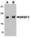 Serine And Arginine Rich Splicing Factor 3 antibody, MBS153478, MyBioSource, Western Blot image 