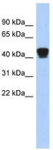 Endoplasmic Reticulum Protein 44 antibody, TA344227, Origene, Western Blot image 