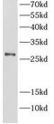 T Cell Receptor Associated Transmembrane Adaptor 1 antibody, FNab08954, FineTest, Western Blot image 