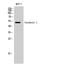 Ribosomal RNA Processing 8 antibody, STJ92237, St John