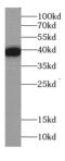 Natural Cytotoxicity Triggering Receptor 2 antibody, FNab01468, FineTest, Western Blot image 