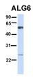 ArfGAP With Coiled-Coil, Ankyrin Repeat And PH Domains 3 antibody, orb77484, Biorbyt, Western Blot image 