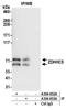 Zinc Finger DHHC-Type Containing 5 antibody, A304-653A, Bethyl Labs, Immunoprecipitation image 