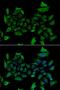 5'-Aminolevulinate Synthase 1 antibody, LS-C334773, Lifespan Biosciences, Immunofluorescence image 