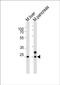 Homeobox protein notochord antibody, PA5-49419, Invitrogen Antibodies, Western Blot image 