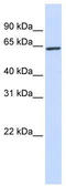 Kelch Like Family Member 25 antibody, TA337996, Origene, Western Blot image 