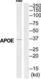 Apolipoprotein E antibody, TA326291, Origene, Western Blot image 