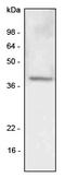 HAR antibody, SM6007S, Origene, Western Blot image 