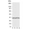 CA3 antibody, R30509, NSJ Bioreagents, Western Blot image 