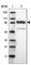 PPFIA Binding Protein 2 antibody, HPA001935, Atlas Antibodies, Western Blot image 