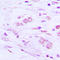 BAI1 Associated Protein 2 Like 1 antibody, LS-C354184, Lifespan Biosciences, Immunohistochemistry paraffin image 