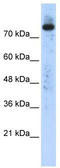 Phospholipase D2 antibody, TA335809, Origene, Western Blot image 