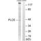 1-Acylglycerol-3-Phosphate O-Acyltransferase 5 antibody, A10870, Boster Biological Technology, Western Blot image 