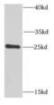 Phosphoserine Phosphatase antibody, FNab06902, FineTest, Western Blot image 