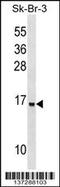 Urp antibody, 59-297, ProSci, Western Blot image 