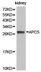 Amyloid P Component, Serum antibody, LS-B12921, Lifespan Biosciences, Western Blot image 