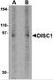 DISC1 Scaffold Protein antibody, 4293, ProSci, Western Blot image 