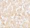Ucp antibody, A00255, Boster Biological Technology, Immunohistochemistry paraffin image 
