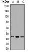 Branched Chain Amino Acid Transaminase 1 antibody, abx133761, Abbexa, Western Blot image 