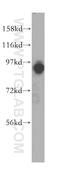 ArfGAP With Coiled-Coil, Ankyrin Repeat And PH Domains 3 antibody, 17570-1-AP, Proteintech Group, Western Blot image 