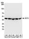 Glutamic-Oxaloacetic Transaminase 2 antibody, A304-356A, Bethyl Labs, Western Blot image 