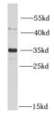 Metaxin 1 antibody, FNab05424, FineTest, Western Blot image 
