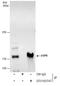Ubiquitin carboxyl-terminal hydrolase 8 antibody, GTX103747, GeneTex, Immunoprecipitation image 