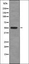 BCL2 Like 11 antibody, orb335916, Biorbyt, Western Blot image 