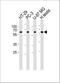 2'-5'-Oligoadenylate Synthetase Like antibody, A04123-1, Boster Biological Technology, Western Blot image 