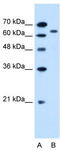 Solute Carrier Family 22 Member 3 antibody, TA333714, Origene, Western Blot image 