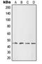 LIM Homeobox 1 antibody, LS-C352449, Lifespan Biosciences, Western Blot image 