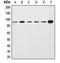 Catenin Beta 1 antibody, orb213800, Biorbyt, Western Blot image 