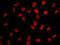 Bromodomain Containing 2 antibody, IHC-00612, Bethyl Labs, Immunofluorescence image 