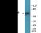 Checkpoint Kinase 2 antibody, EKC2022, Boster Biological Technology, Western Blot image 