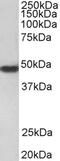 PAR-1 antibody, PA5-19102, Invitrogen Antibodies, Western Blot image 