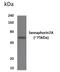 SEMA7A antibody, GTX52991, GeneTex, Western Blot image 