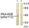 Protein Kinase CAMP-Dependent Type II Regulatory Subunit Beta antibody, TA313079, Origene, Western Blot image 
