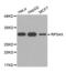 Ribosomal Protein S4 X-Linked antibody, abx003011, Abbexa, Western Blot image 