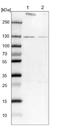 Ring Finger Protein 40 antibody, NBP1-88356, Novus Biologicals, Western Blot image 