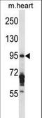 Exocyst Complex Component 6B antibody, LS-C167860, Lifespan Biosciences, Western Blot image 