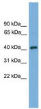 DnaJ Heat Shock Protein Family (Hsp40) Member B12 antibody, TA342340, Origene, Western Blot image 
