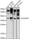 Solute Carrier Family 25 Member 44 antibody, LS-C750336, Lifespan Biosciences, Western Blot image 