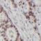 Exosome complex exonuclease RRP4 antibody, FNab02902, FineTest, Immunohistochemistry paraffin image 