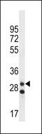 Leucine Rich Repeat Containing 3C antibody, LS-C203749, Lifespan Biosciences, Western Blot image 