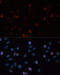 DNA Methyltransferase 3 Beta antibody, 18-859, ProSci, Immunofluorescence image 